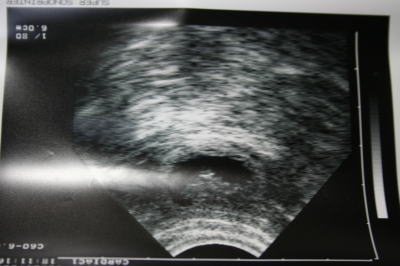 妊娠犬1ヶ月のエコー写真