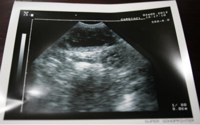 トイプードル犬の妊娠、交配1ヶ月エコー画像