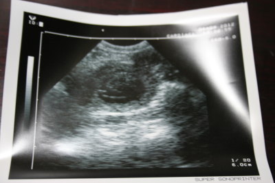 トイプードル犬の妊娠交配1ヶ月エコー画像