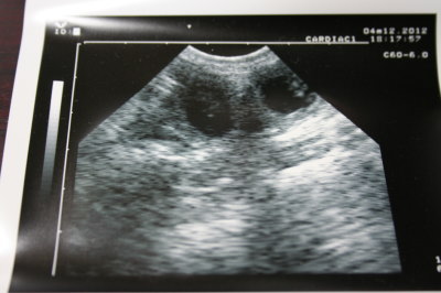 トイプードル犬の妊娠交配1ヶ月エコー画像
