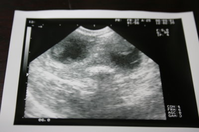 犬の交配1ヶ月後のエコーでの妊娠確認画像